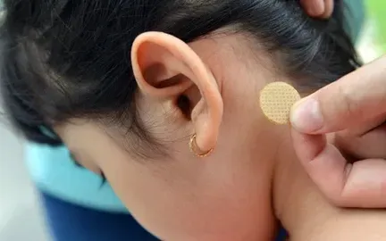 Bác sĩ cảnh báo nguy cơ từ miếng dán chống say tàu xe ở trẻ nhỏ