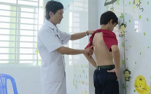 Báo động gia tăng bệnh gù vẹo cột sống học đường trong dịp hè