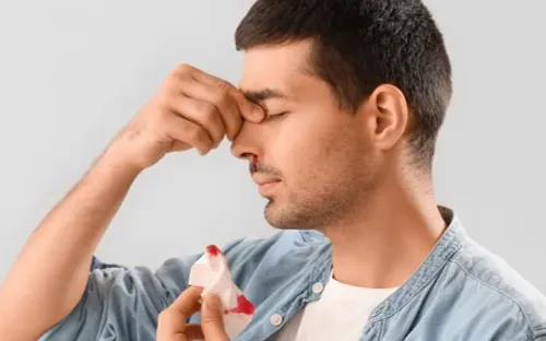 Nắng nóng, dùng điều hòa nhiều dễ gây chảy máu cam mùa hè