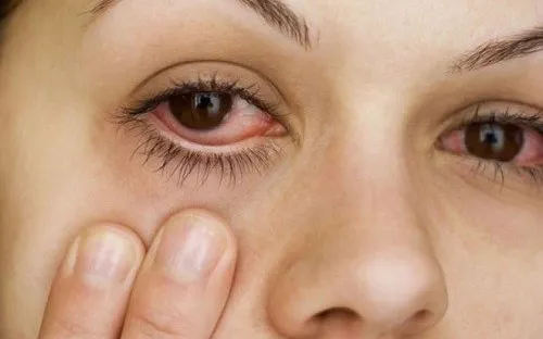 Nhiều bệnh lý nguy hiểm có thể được cảnh báo qua đôi mắt