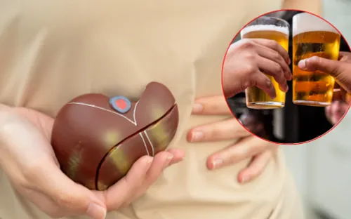 Sau những cuộc nhậu kéo dài, gan có thực sự cần “giải độc”?