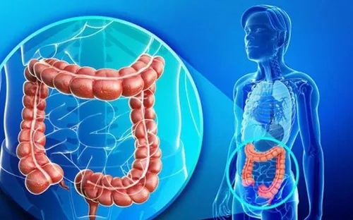 Rối loạn tiêu hóa kéo dài có thể là dấu hiệu của hội chứng ruột kích thích