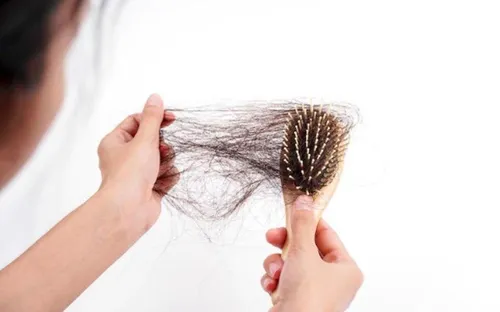 Rụng tóc nhiều có thể là dấu hiệu cơ thể đang thiếu những dưỡng chất quan trọng