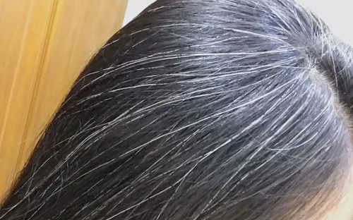 Chưa đến tuổi trưởng thành tóc đã bạc, cơ thể đang muốn cảnh báo điều gì?