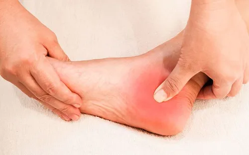 Gai gót chân cảnh báo bệnh gì? Đừng chủ quan khi cơn đau xuất hiện mỗi sáng