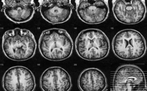 Đo mức độ cơn đau nhờ... chụp cắt lớp não