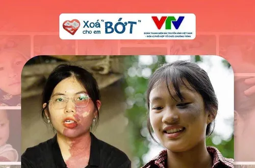 Đoàn Thanh niên Đài Truyền hình Việt Nam chính thức đồng hành cùng "Xóa 'bớt' cho em"