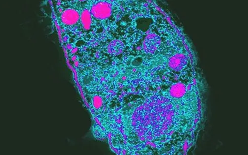 Cảnh báo bùng phát bệnh nhiễm ký sinh trùng toxoplasma tại Brazil