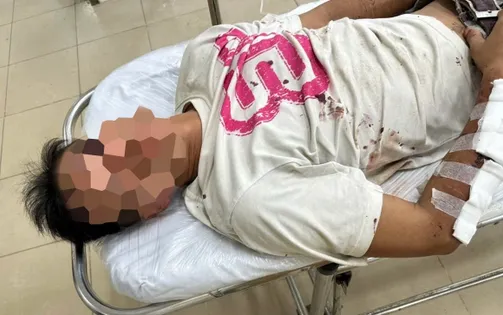 Bắt đối tượng truy nã khi xử lý tai nạn giao thông