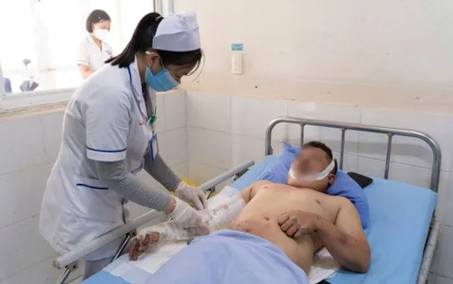 Sức khỏe 12 nạn nhân vụ nổ máy phủ ở Quảng Nam cơ bản ổn định