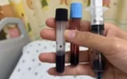 Bé gái 16 tháng suýt mất mạng vì máu biến đổi không thể mang oxy