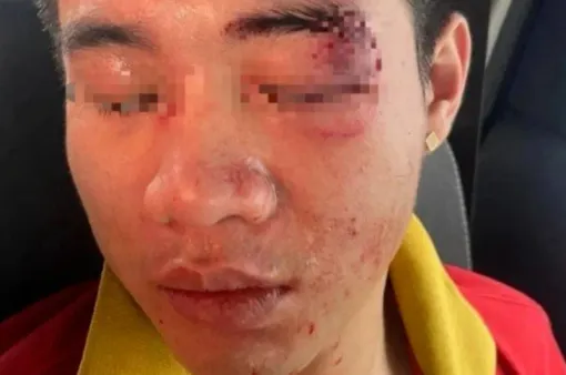 Điều tra vụ nam nhân viên nhà xe ở Hà Nội bị đánh hội đồng