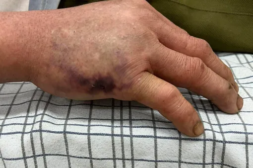 Mùa mưa - Mùa rắn cắn: Cảnh giác hiểm họa rình rập