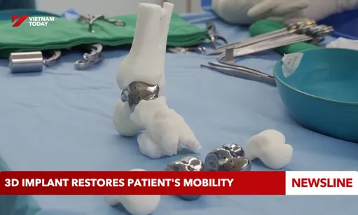3D implant restores patient's mobility