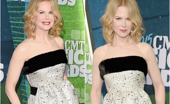 CMT Awards 2015: Nicole Kidman khoe mặt "cứng đờ" như tượng sáp