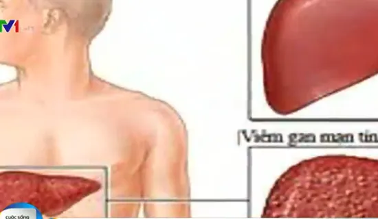 Khó tránh khỏi nhiễm bệnh viêm gan C khi xăm hình