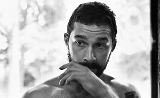 Shia LaBeouf vỡ đầu, phải khâu 20 mũi vì phim mới?