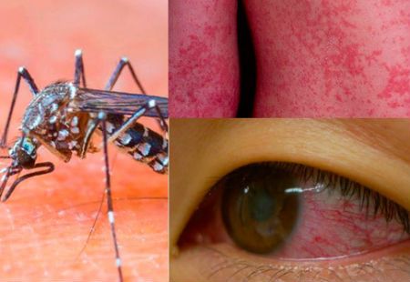 Đối phó virus Zika bằng bột giặt cải tiến và cá bảy màu