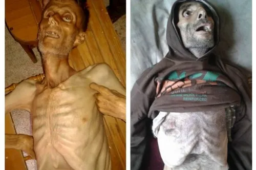 Madaya trở thành "địa ngục trần gian" trong cuộc chiến vây hãm tại Syria