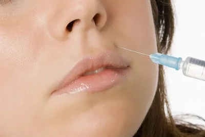 Tự ý tiêm Botox có thể nguy hiểm đến tính mạng