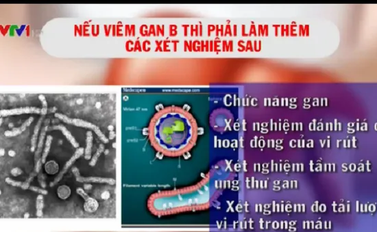 Tư vấn chẩn đoán, xét nghiệm bệnh viêm gan virus B và C