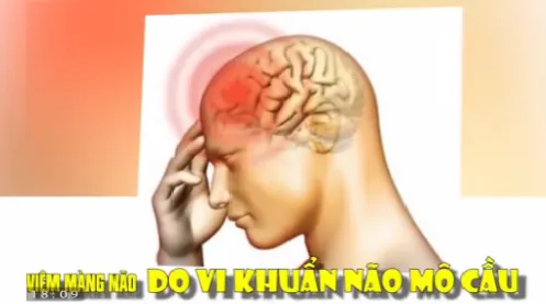 Dấu hiệu nhận biết sớm viêm não mô cầu