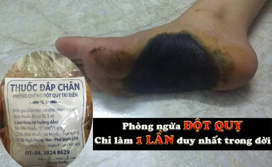 Thực hư về bài thuốc Đông y đắp bàn chân phòng ngừa độ quỵ