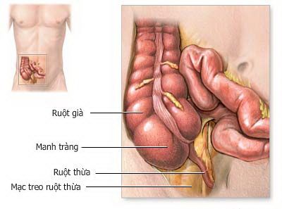 Bệnh viêm đại tràng co thắt dễ tái phát