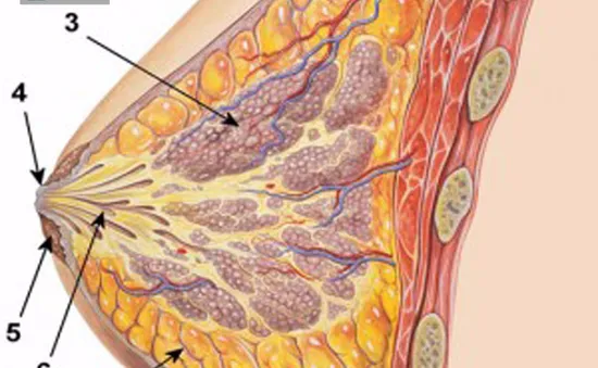 Khi có những dấu hiệu này, 80% bạn đã mắc ung thư vú