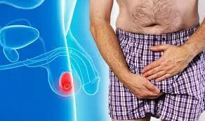 Điều trị thương tích ở tinh hoàn như thế nào?
