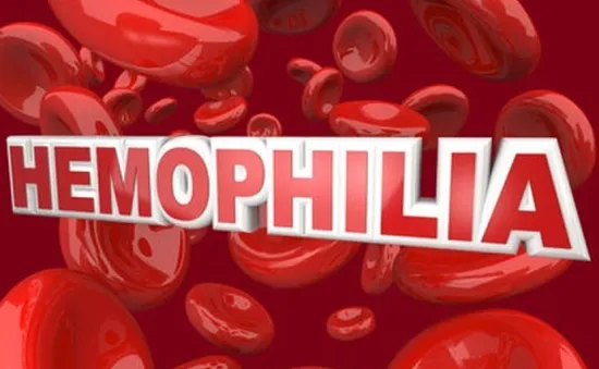 Hemophilia: bệnh cực kỳ nguy hiểm, gánh nặng lớn của xã hội