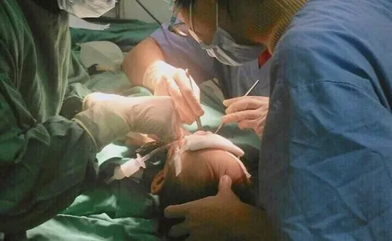 Nghệ An: Điều trị răng cho trẻ bằng phương pháp gây mê