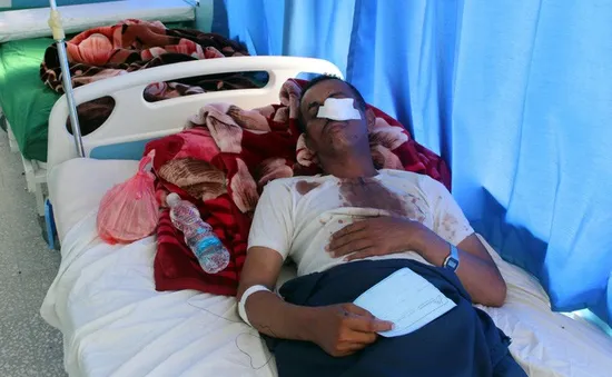 Yemen: Dội bom trúng đám cưới, gần 40 người thiệt mạng