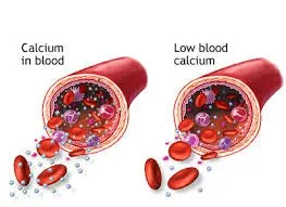 Điều gì xảy ra khi mức canxi cao?