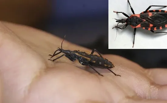 Mỹ: Cảnh báo căn bệnh chết người mang tên “Chagas”