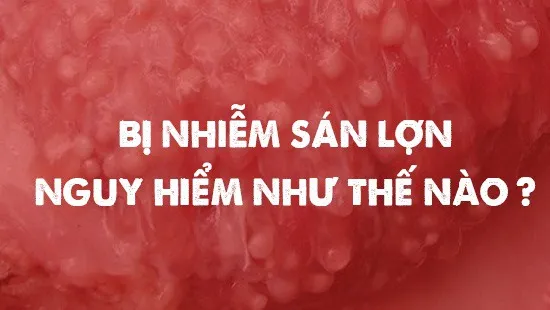 Bị nhiễm sán lợn nguy hiểm như thế nào?