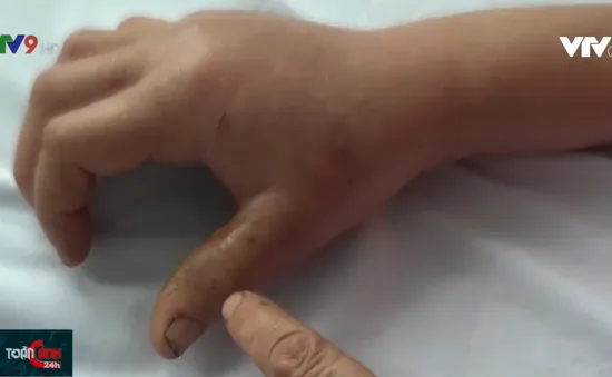 Đề phòng bị rắn tấn công trong mùa mưa