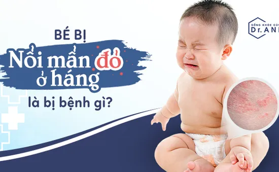 Bé bị nổi mẩn đỏ ở háng là bị bệnh gì?