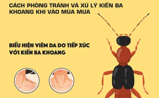 [INFOGRAPHIC] Mẹo phòng tránh và xử trí kiến ba khoang khi vào mùa mưa