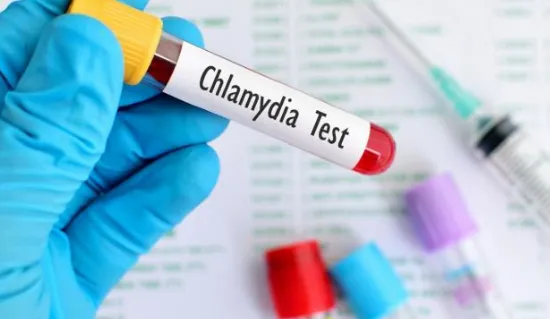 Phòng bệnh lây truyền qua đường tình dục Chlamydia