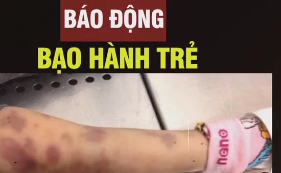 Báo động tình trạng bạo hành trẻ em