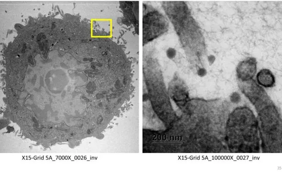 Càng nhiều người nhiễm SARS-CoV-2, virus càng có cơ hội biến chủng