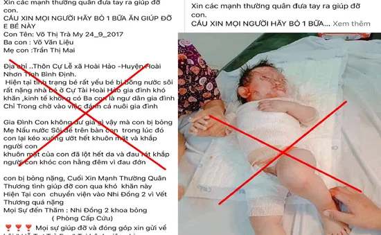 Cảnh báo thông tin sai sự thật kêu gọi giúp đỡ bệnh nhi bị bỏng nặng