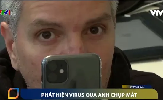 Phát hiện nhanh virus qua ảnh chụp mắt