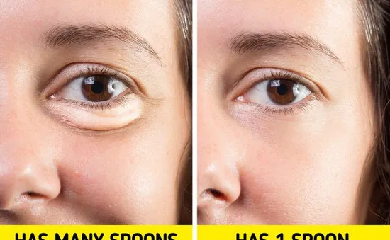 7 bí quyết “loại bỏ vĩnh viễn” tình trạng sưng mặt, bọng mắt và các bộ phận khác