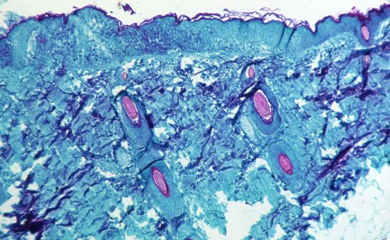 Giải mã virus: Đậu mùa khỉ và những câu hỏi nóng nhất