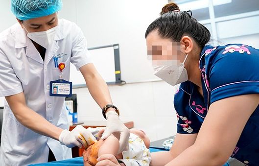 Xử trí kịp thời khối u máu lớn viêm loét và hoại tử nặng cho bé trai 5 tháng tuổi