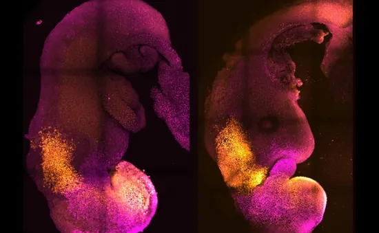 Tạo ra phôi chuột “tổng hợp” đã phát triển não bộ, dây thần kinh và mô tim đập