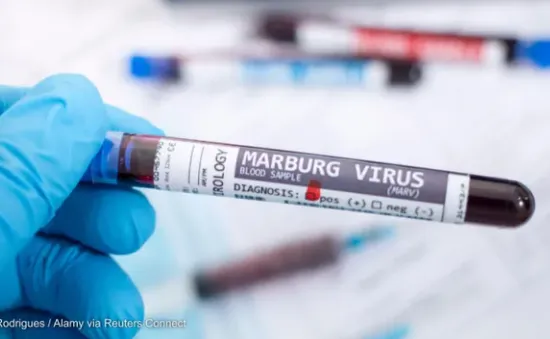 WHO họp khẩn vì ổ dịch sốt xuất huyết do virus Marburg