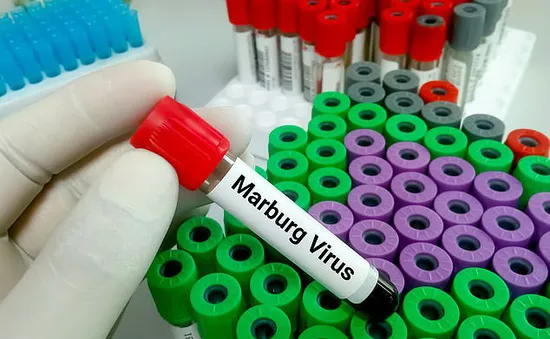 Bùng phát virus Marburg gây tử vong cao ở Tanzania